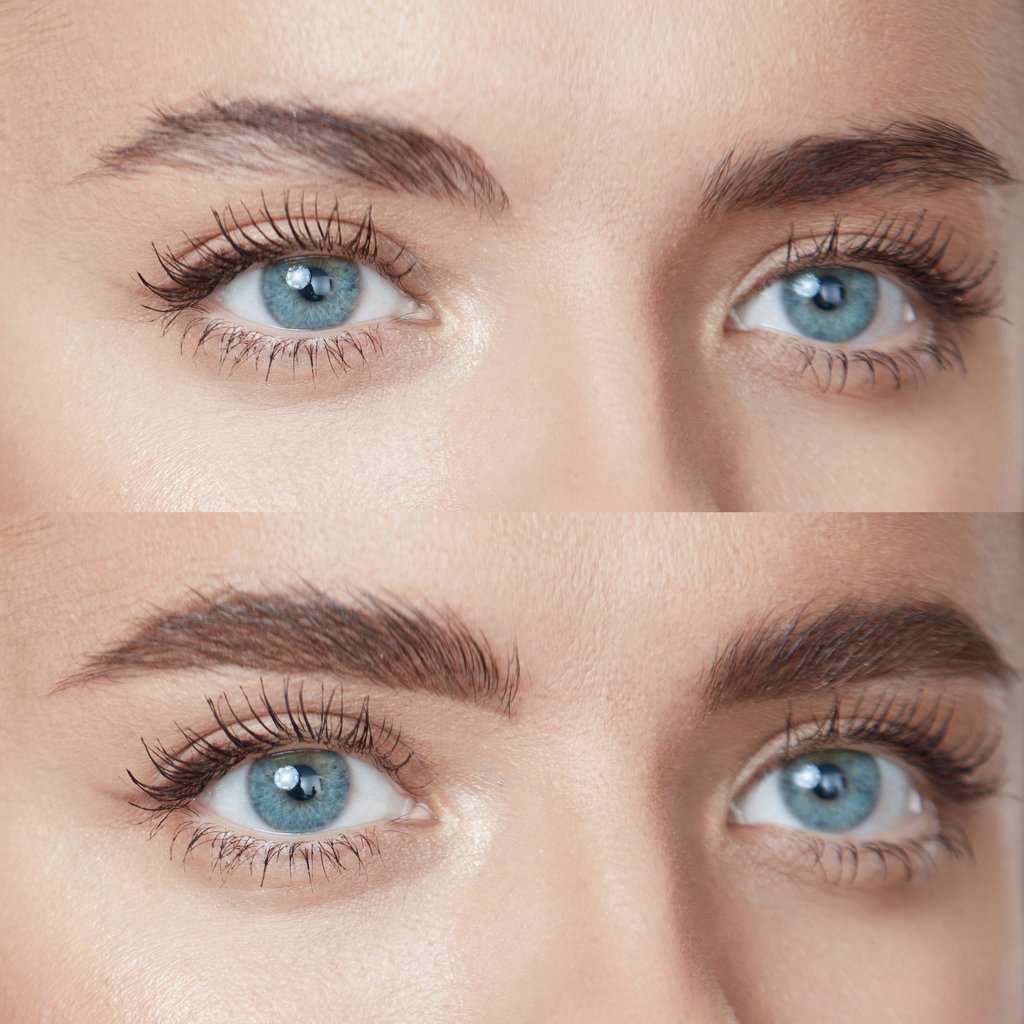 Que Tiene Las Cejas Tan Pobladas Que Se Unen